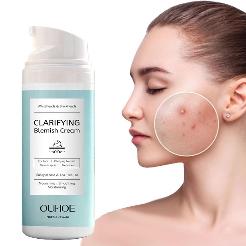 Salicylic Acid Blackhead Remover - ครีมกำจัดสิวกรดซาลิไซลิก บำรุงผิว บางเบา ไม่เหนียวเหนอะหนะ ครีมกำจัดสิวกรดซาลิไซลิกสำหรับสิวหัวขาว สิวหัวดำ