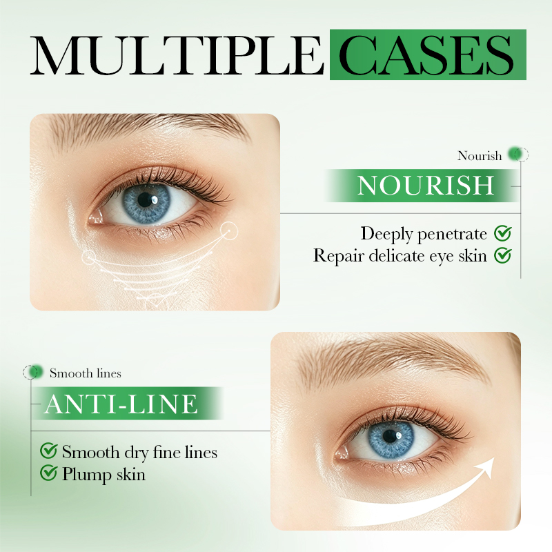60 ชิ้น แผ่นมาส์กใต้ตา SADOER  - Collagen Under Eye Patches บทวิจารณ์และราคา